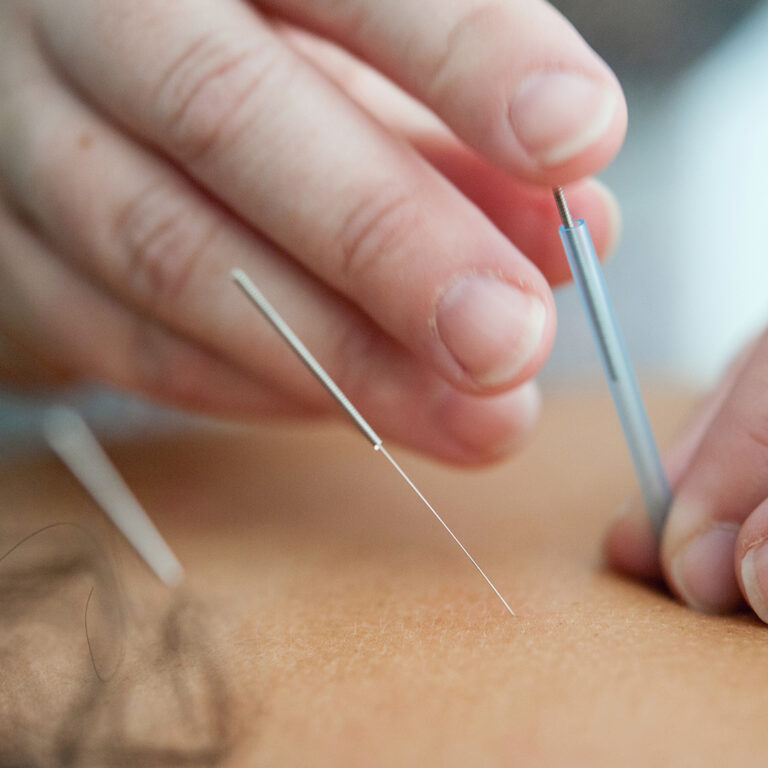 Terapia olistica agopuntura Giorgio Ajraldi